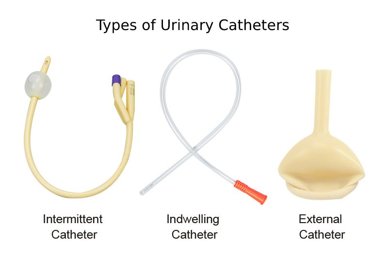 Types of Urinary Catheters Типы мочевых катетеров