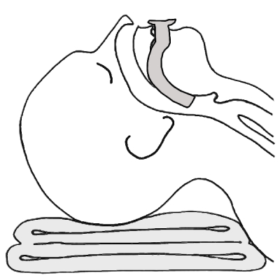 Ротоглоточные дыхательные пути